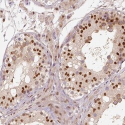 MUM1L1 Antibody, Novus Biologicals 25 &mu;L; Unlabeled:Antibodies, Polyclonal
